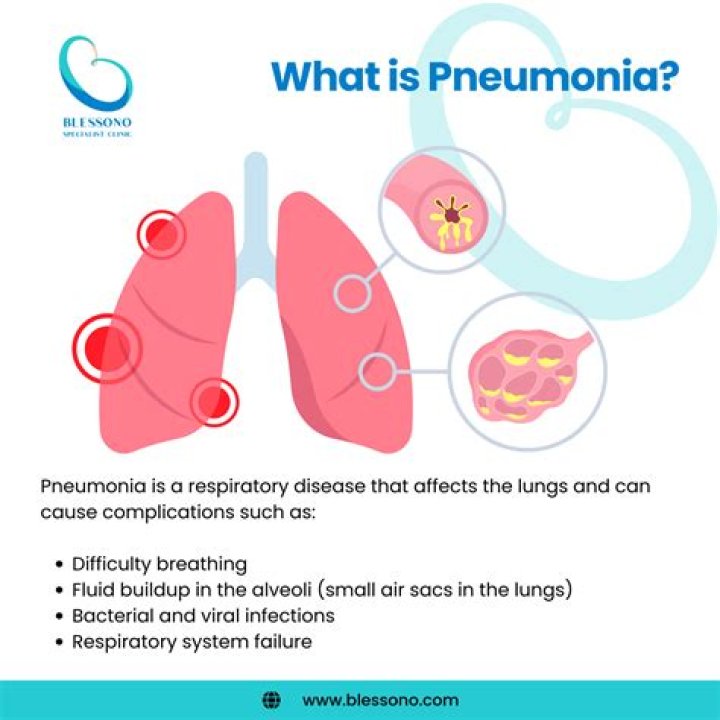 Fernando Botero: Renowned Colombian Painter and Sculptor Dies at 91 Due to Pneumonia Complications